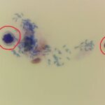 赤丸：好中球 好中球の間にあるものは細菌