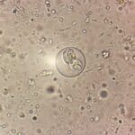 倍率を上げて確認したコクシジウム