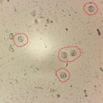 顕微鏡にて確認したコクシジウム(赤丸全て)