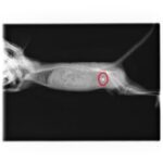 レントゲンで確認された結石