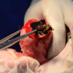 異物を取り除いている様子