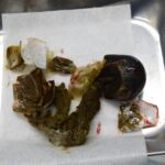 摘出された異物